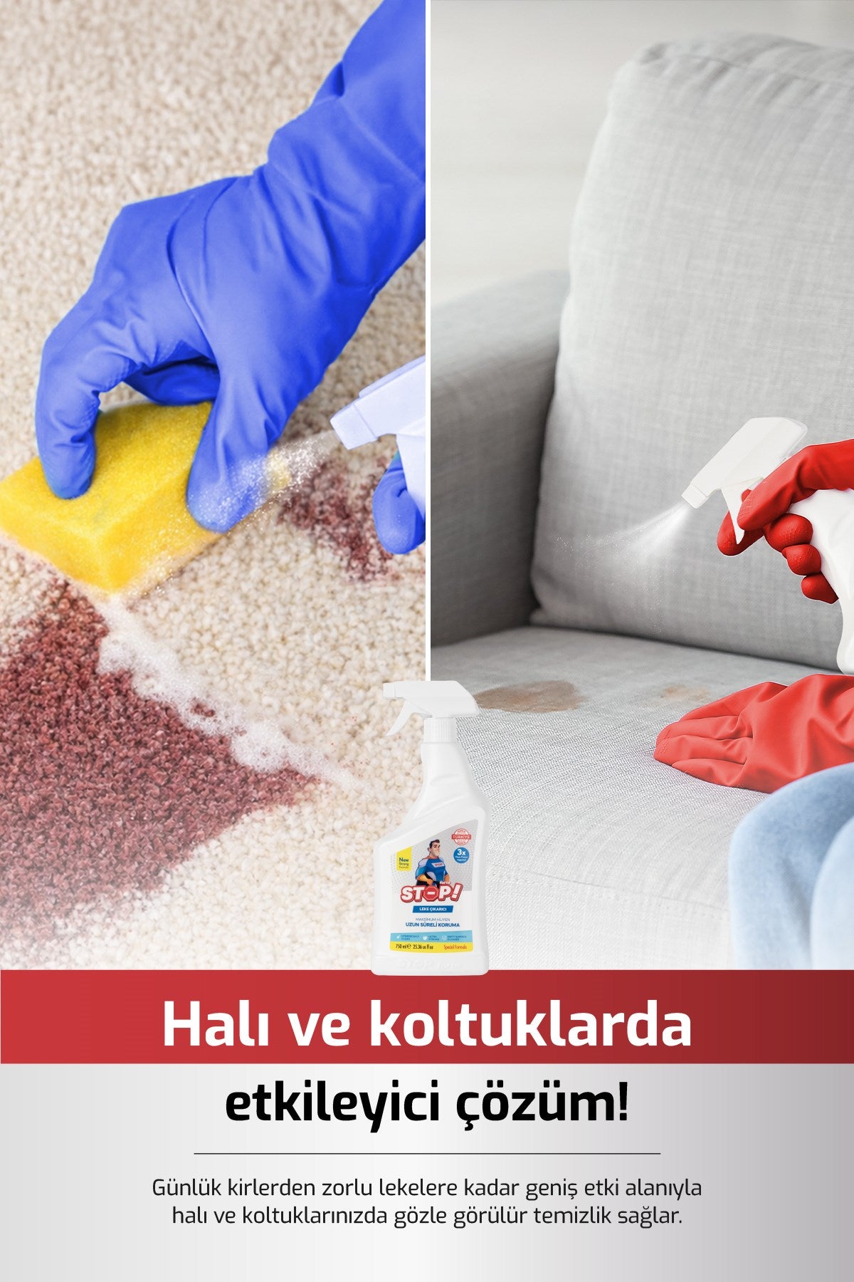 Stop Forte Leke Çıkarıcı 750 ml